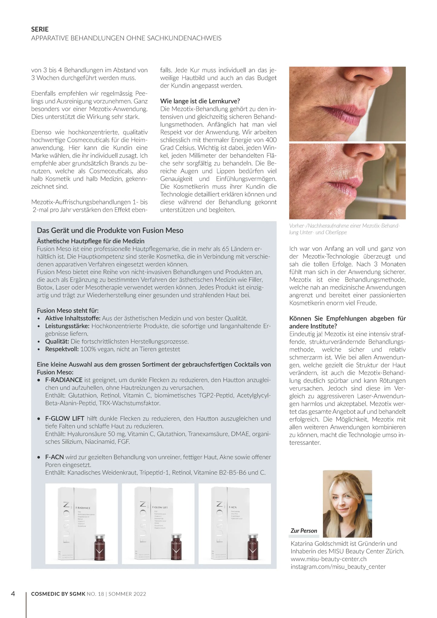 204280-tixel-mezotix