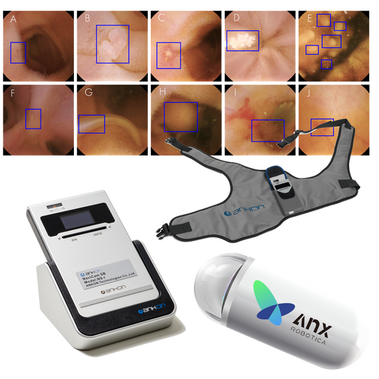 navicam™-sb-–-die-erste-hochauflösende-kapselendoskopie-mit-künstlicher-intelligenz-a.i.-kapselendoskopie