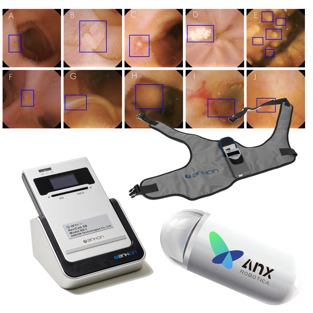 navicam™-sb-–-die-erste-hochauflösende-kapselendoskopie-mit-künstlicher-intelligenz-a.i.-kapselendoskopie